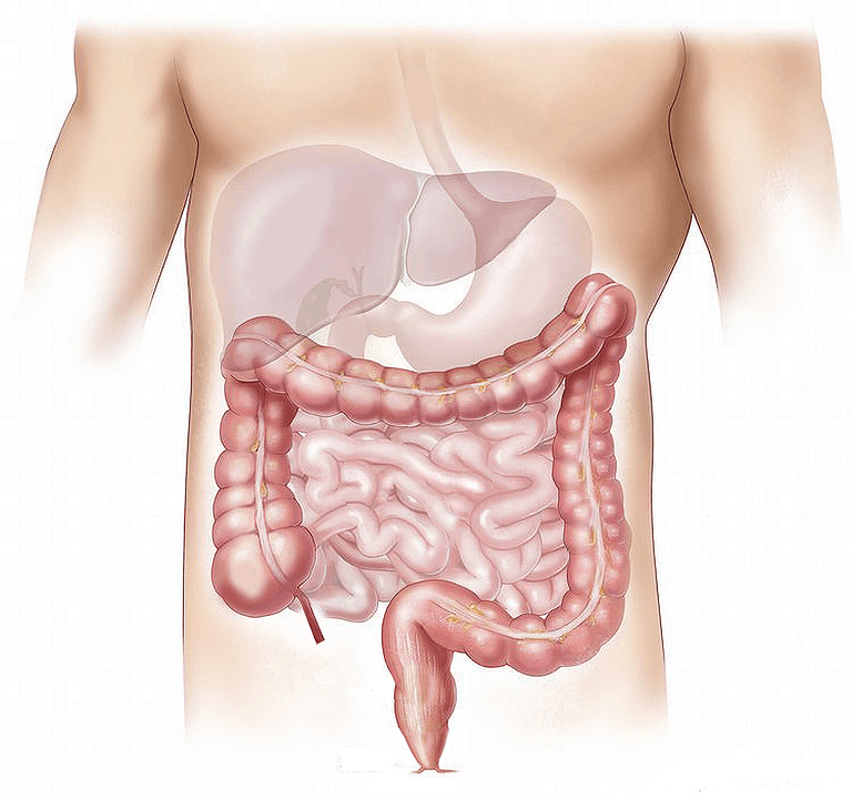 Ileus and Bowel Obstruction: इंटेस्टाइनल इलियस क्या है?