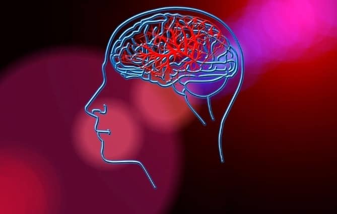 दिमाग को क्षति पहुंचाता है स्ट्रोक, जानें कैसे जानलेवा हो सकती है ये स्थिति