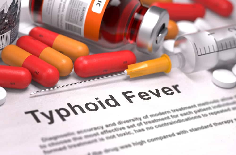 Typhoid Fever: टायफॉइड फीवर क्या है? जानें इसके कारण, लक्षण और उपाय