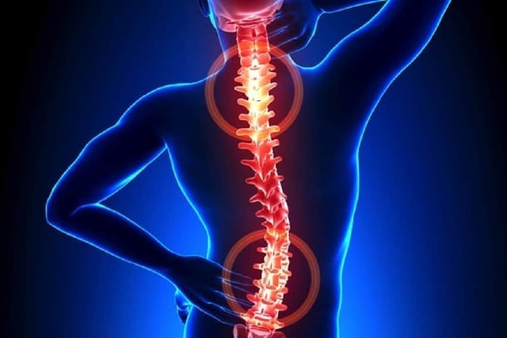 Spinal tumor: स्पाइनल ट्यूमर क्या है?