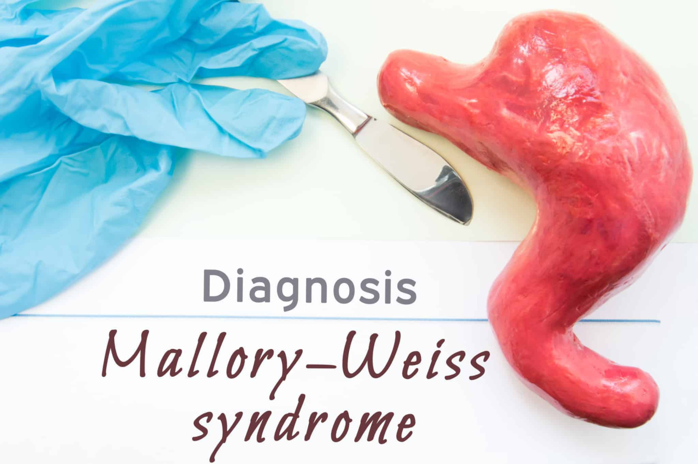 Mallory-Weiss Syndrome: मैलरी-वाइस सिंड्रोम क्या है?