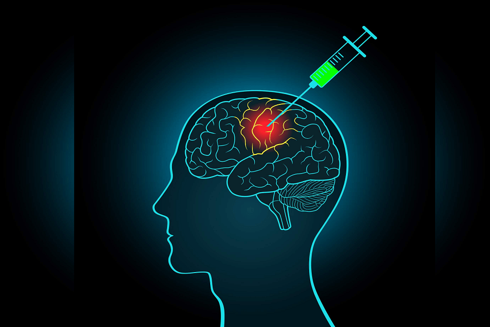 International Epilepsy Day : इन सर्जरीज से किया जा सकता है मिर्गी का इलाज