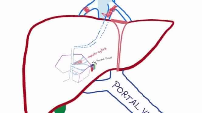 Budd-Chiari syndrome : बड चैरी सिंड्रोम क्या है?
