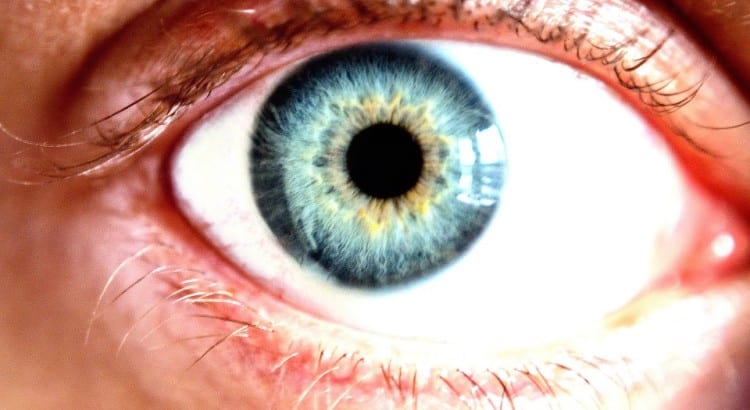 Corneal flash burns : कॉर्नियल फ्लैश बर्न क्या है, यह कैसे होता है?