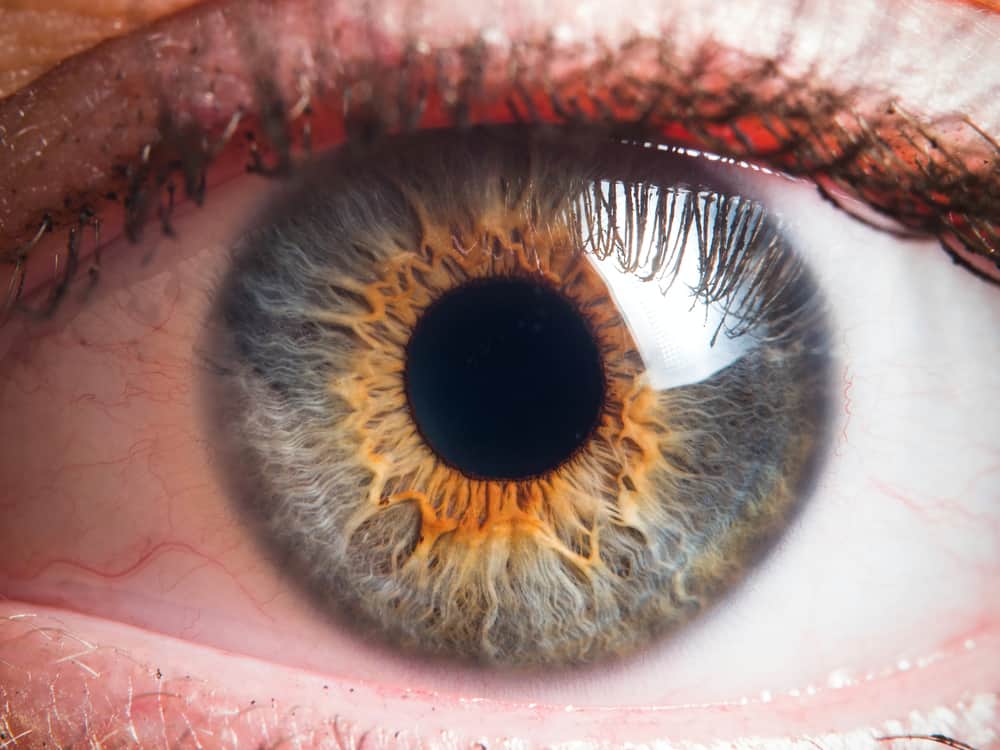 आई कैंसर (eye cancer) के लक्षण, कारण और इलाज, जिसे जानना है बेहद जरूरी