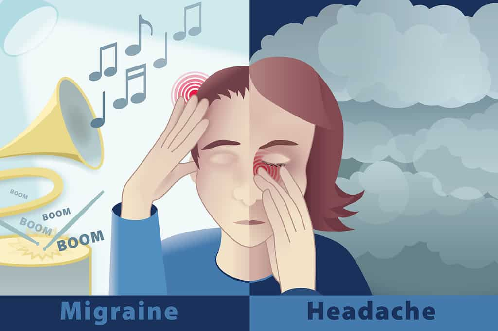 माइग्रेन की समस्या-migraine facts