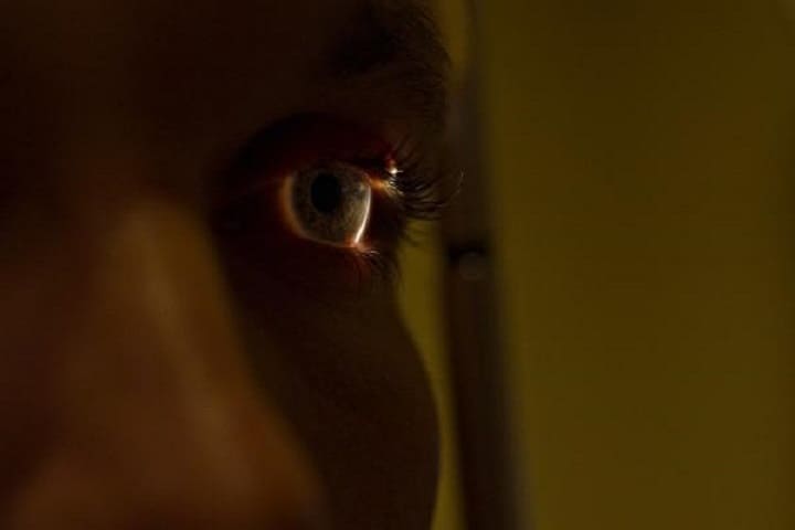 Nearsightedness : नियरसाइटेडनेस (निकटदर्शिता) क्या है? जानिए इसका उपचार