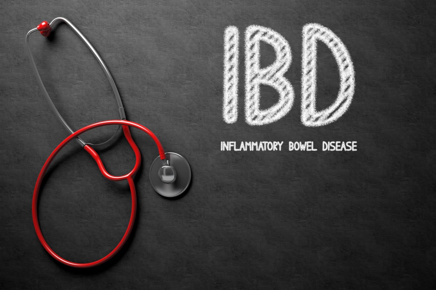 Inflammatory Bowel Disease (IBD): इंफ्लेमेटरी बाउल डिजीज क्या है? जानिए इसके कारण, लक्षण और उपचार