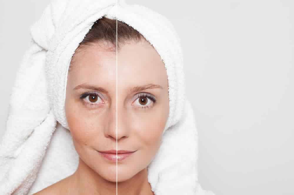 स्किन टाइटनिंग के लिए एक बार आजमाकर देखें ये उपाय, दिखने लगेंगे जवान