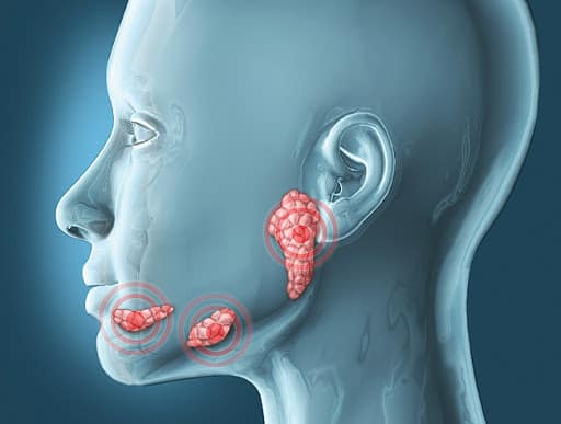 ड्राई माउथ सिंड्रोम या जेरोस्टोमिया (Xerostomia ) क्या है?