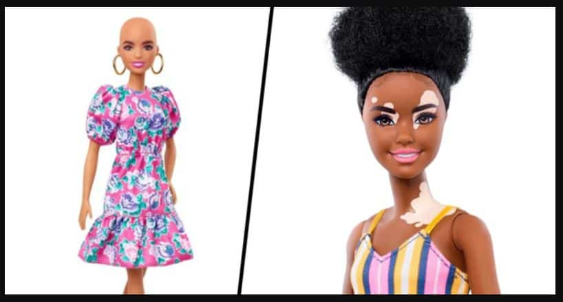 बार्बी डॉल के नए फीचर में दिखी विटिलिगो बीमारी, विविधता और समानता दिखाना उद्देश्य