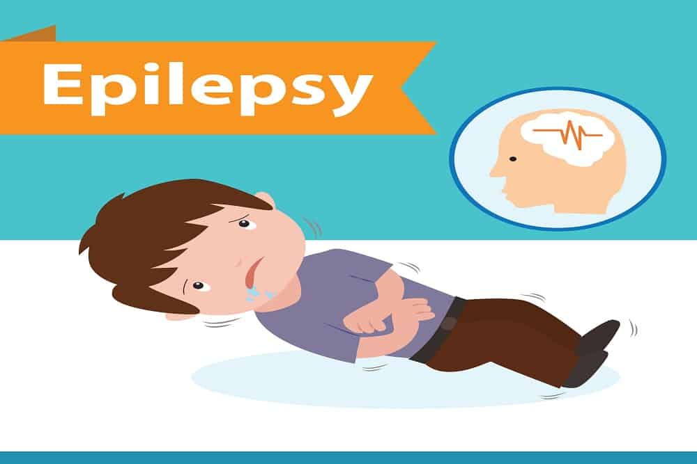 बदबूदार जूता सूंघाने या CPR देने से पहले, जरूर जानें मिर्गी से जुड़े मिथक