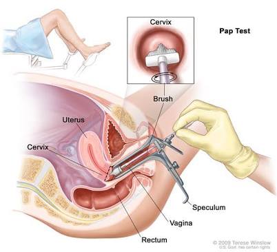Pap Smear Test: पैप स्मीयर टेस्ट क्या है?
