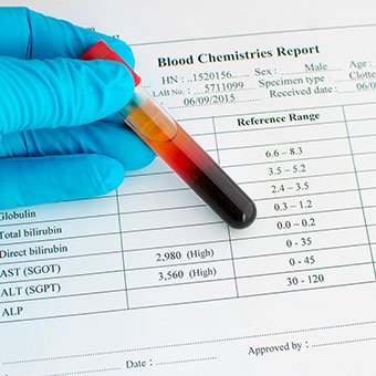 Serum Glutamic Pyruvic Transaminase (SGPT): सीरम ग्लूटामिक पाइरुविक ट्रांसएमिनेस (एसजीपीटी) टेस्ट क्या है?