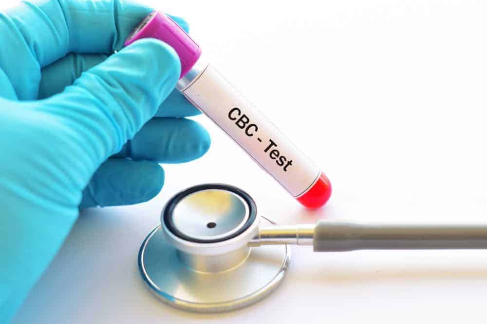 Complete Blood Count Test: Why and How is it Done?