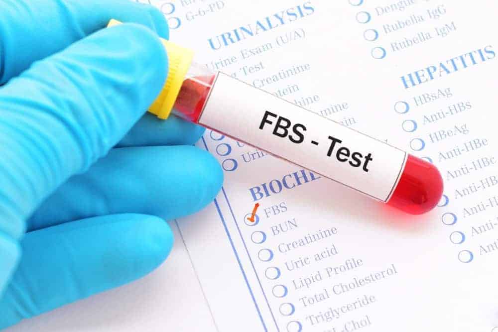 FBS Test (Fasting Blood Sugar): Why and How is it Done?