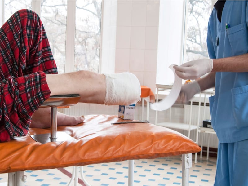 Amputation: What is it and How is it Done?