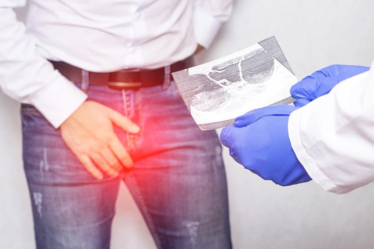 Epididymitis: एपिडिडीमाइटिस क्या है?