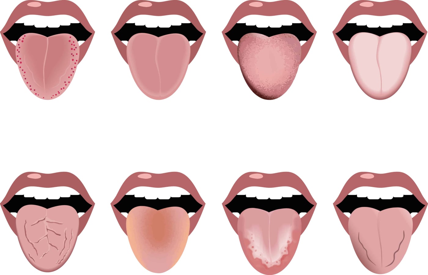 आखिर कैसा होना चाहिए स्वस्थ जीभ का रंग?