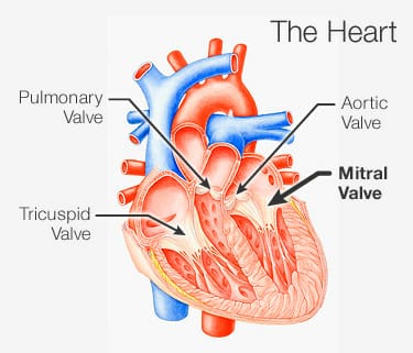 Mitral valve prolapse: माइट्रल वाल्व प्रोलैप्स क्या है?