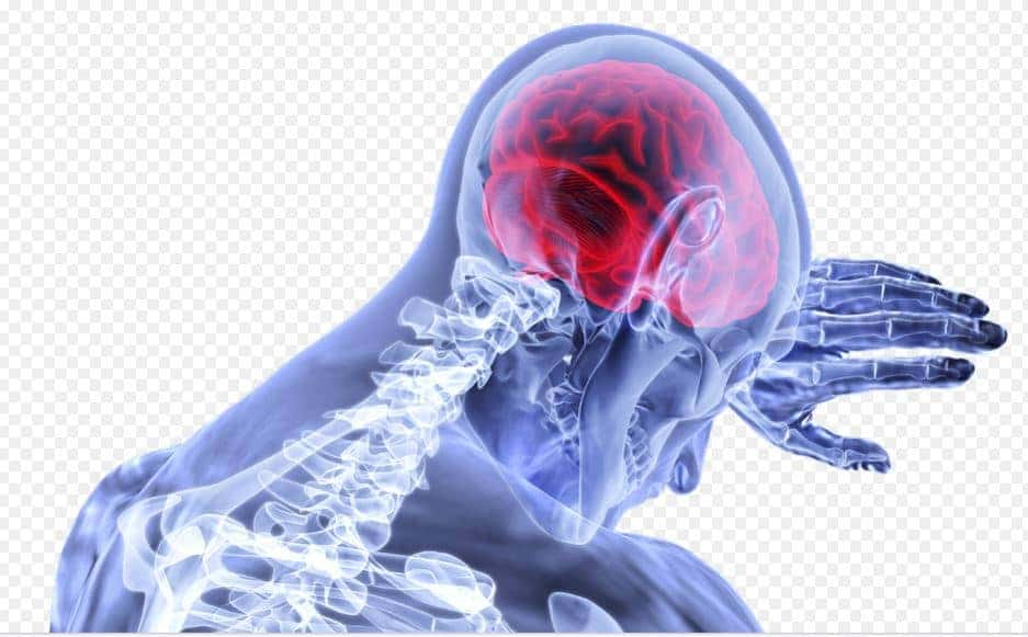 Transient ischemic attack: ट्रांसिएंट इस्कीमिक अटैक क्या है?