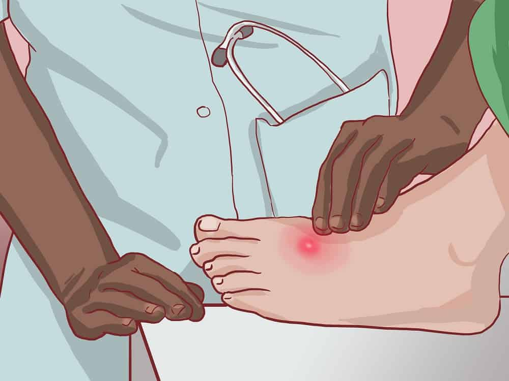 Boils: फोड़ा क्या है?