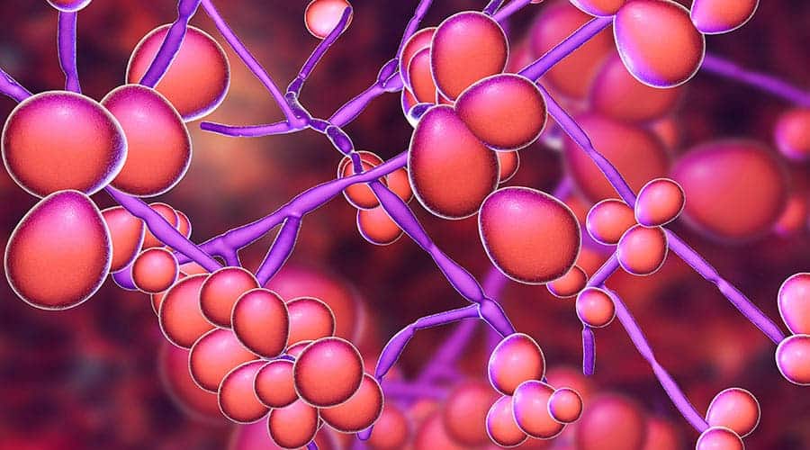 Candidiasis : कैंडीडायसिस क्या है?