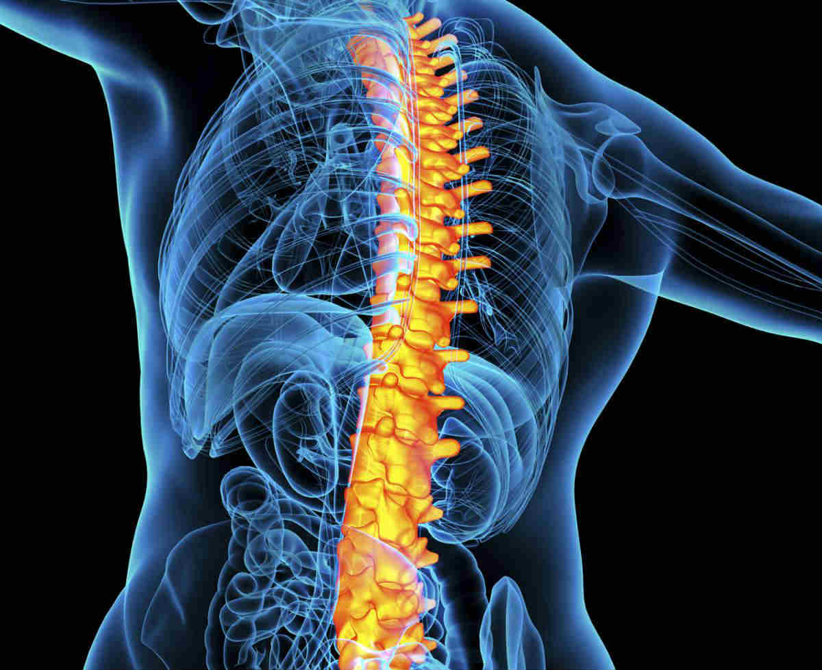 Vertebral compression fracture : वर्टेब्रल कंप्रेशन फ्रैक्चर क्या है?