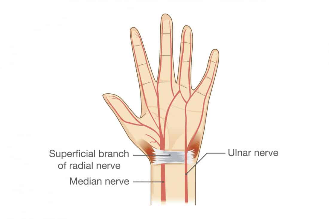 Ulnar Nerve Injury: अलनर नस में चोट क्या है? जानिए इसके कारण, लक्षण और इलाज