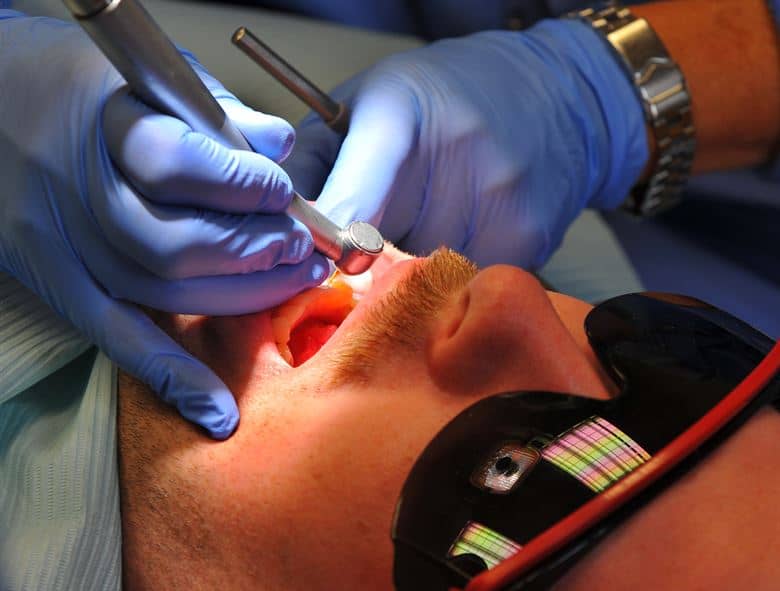 क्या ल्यूकोप्लाकिया (Leukoplakia) या मुंह में सफेद दाग हो सकता है ओरल कैंसर?