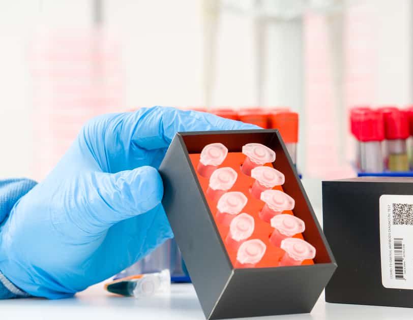 रैपिड एंटीबॉडी ब्लड टेस्ट से जल्द होगी कोरोना पेशेंट की जांच