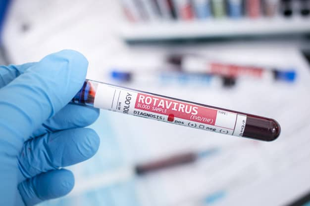 Rotavirus: रोटावायरस क्या है? जानिए कारण लक्षण और इलाज