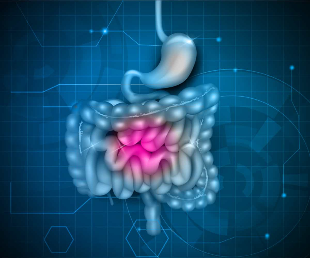Small intestine cancer-छोटी आंत का कैंसर