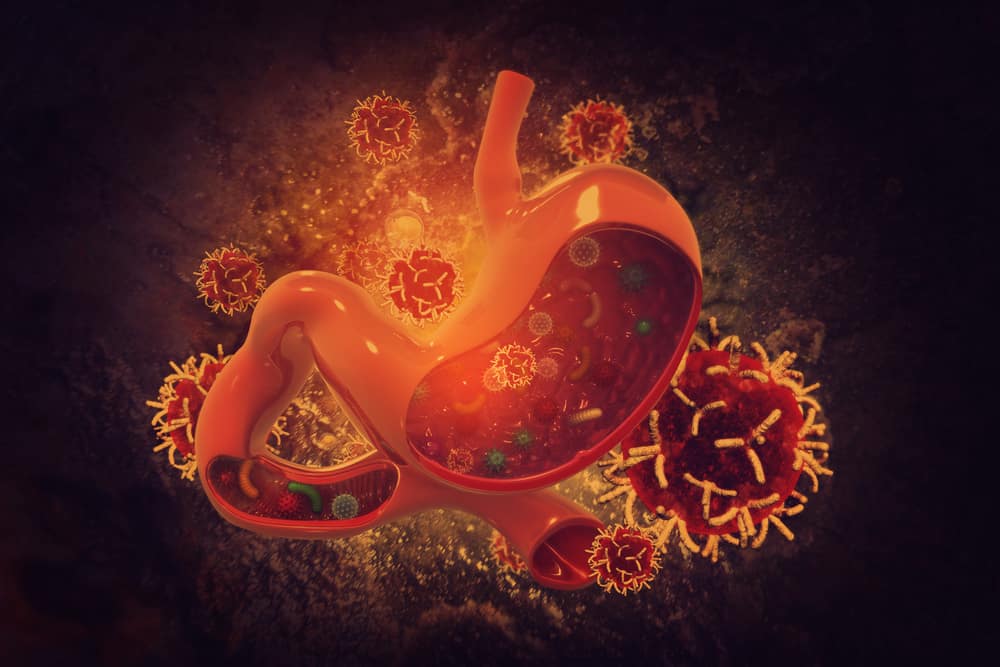 living with stomach cancer