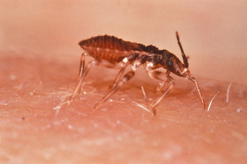 Chagas disease: चगास रोग क्या है?