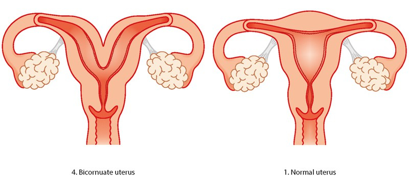 Double Uterus: डबल यूट्रस होना क्या है? जानिए इसके कारण, लक्षण और उपाय