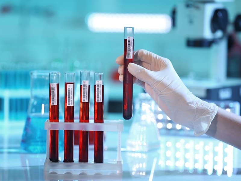 Glucose Challenge Test: Why and How is it Done?