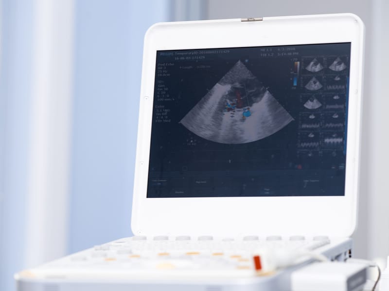 जानें ट्रांसवजायनल अल्ट्रासाउंड क्या है और इसकी जरूरत क्याें पड़ती है...