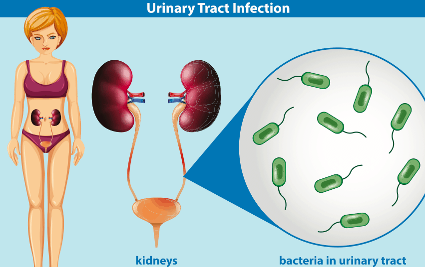 यूरिन इन्फेक्शन का आयुर्वेदिक इलाज क्या है? जानिए दवा और प्रभाव