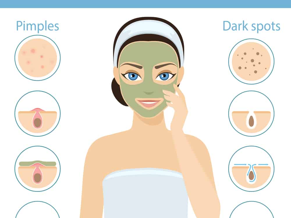 मुंहासे का खुद इलाज करने के तरीके : अब ऐसे करें पिंपल को बाय-बाय