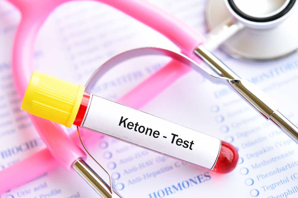 Ketones Test: कीटोन टेस्ट कैसे और क्यों किया जाता है?