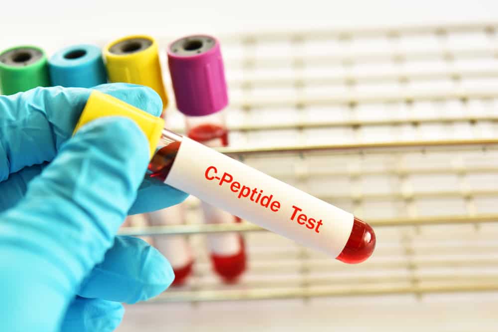 C-peptide: सी-पेप्टाइड कैसे और क्यों किया जाता है?