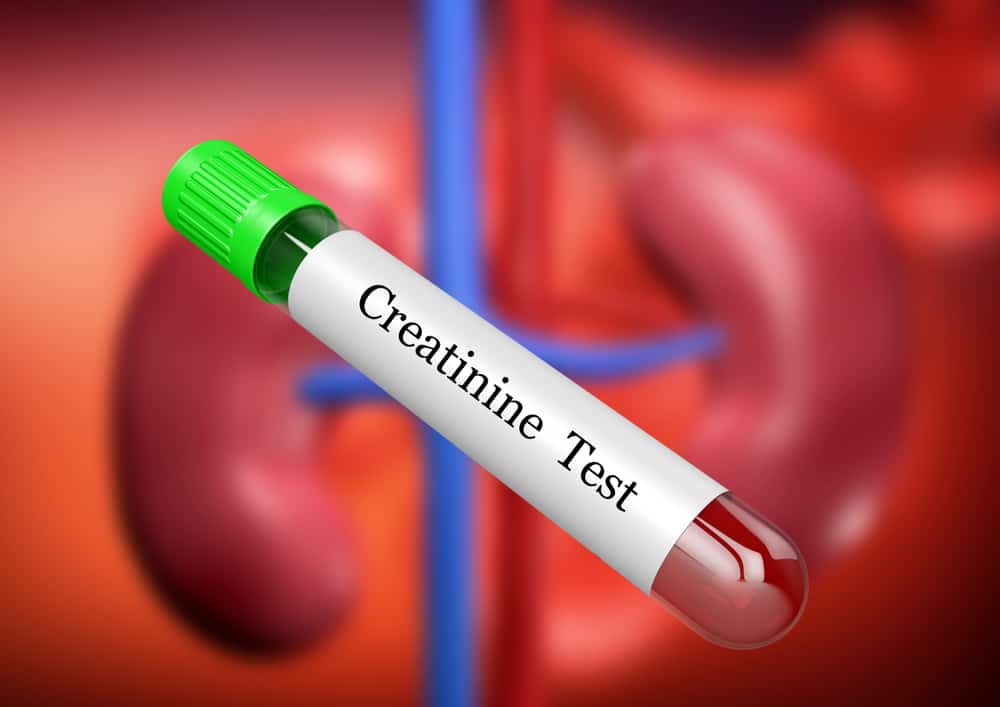 Creatinine: जानिए, क्रिएटिनिन लेवल कम करने के घरेलू उपाय