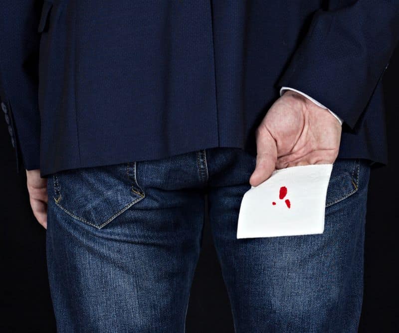 बवासीर या पाइल्स का क्या है आयुर्वेदिक इलाज