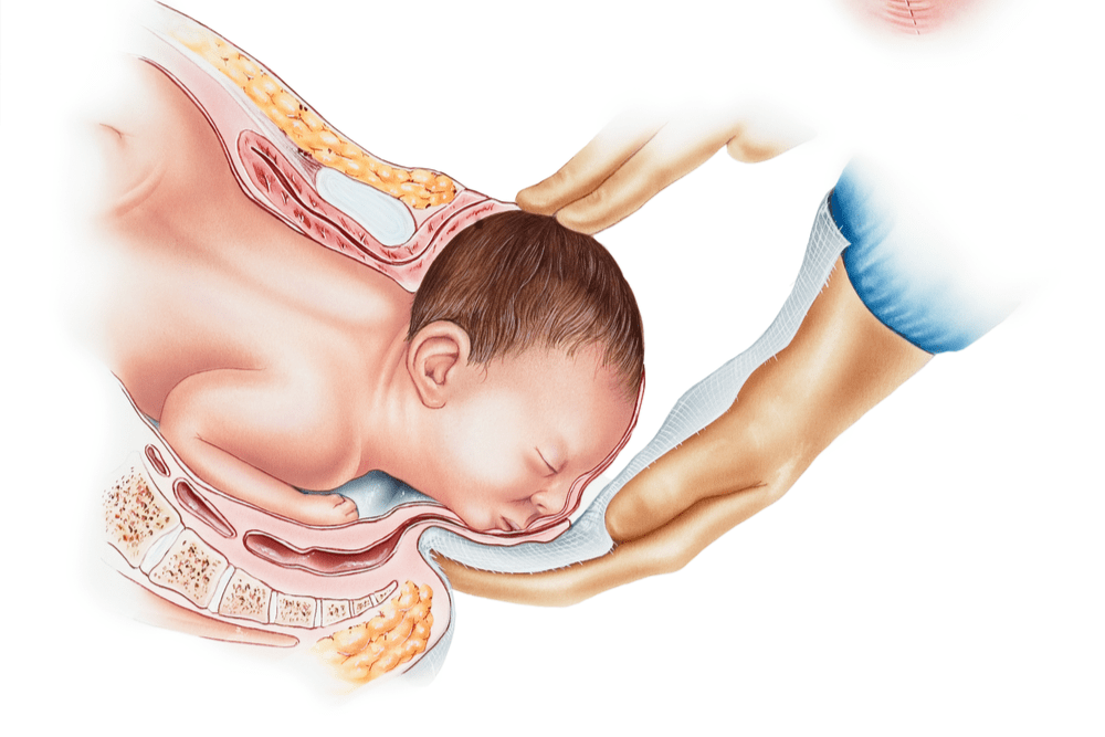 डिलिवरी के दौरान की जाती है एपिसीओटॉमी की प्रोसेस, क्विज खेलकर आप बढ़ा सकते हैं नॉलेज