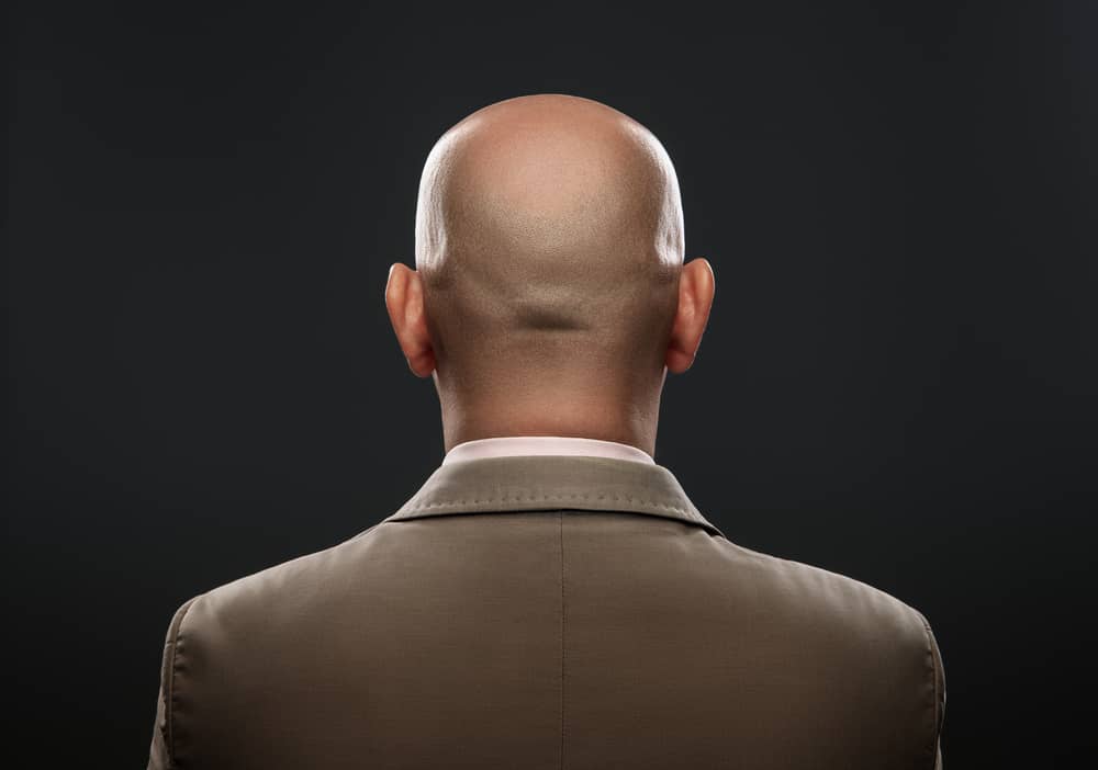 आखिर क्यों होती है पुरुषों को गंजेपन की समस्या ? जानते हैं तो दें जवाब