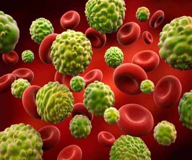 कीमोथेरिपी के साइड इफेक्ट्स को कम किया जा सकता है, इस तरह के योगासन और डायट से