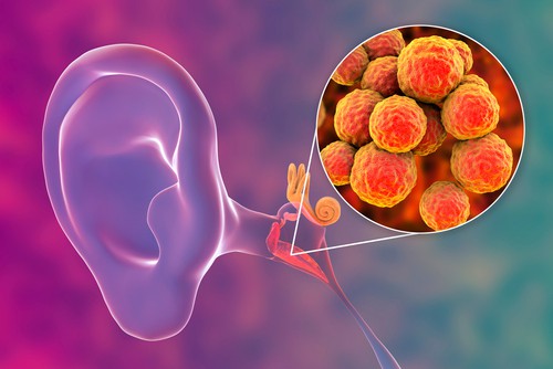 कान के पीछे की स्मेल कहीं इंफेक्शन तो नहीं!