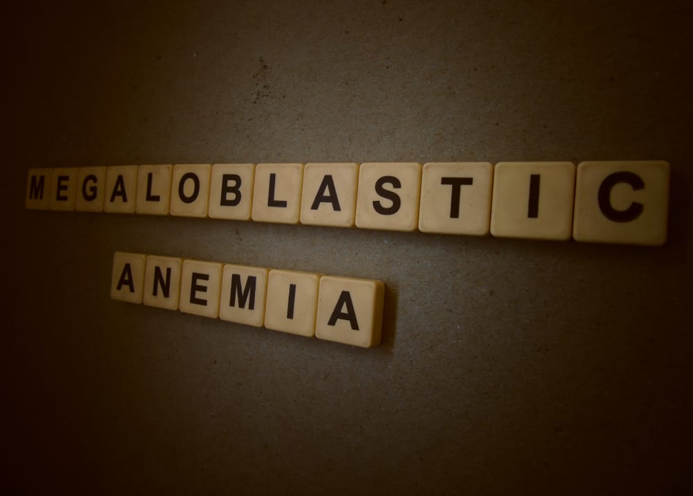 Megaloblastic Anemia: मेगालोब्लास्टिक एनीमिया क्या है? जानिए इसके लक्षण और इलाज
