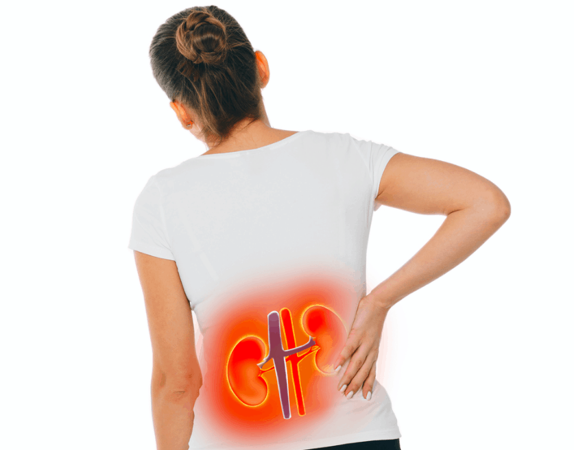 किडनी स्टोन को नैचुरल तरीके से बाहर निकालने का राज छुपा है यूनानी इलाज में